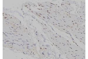ABIN6263438 and ABIN6266721 at 1/100 staining Human gastric tissue by IHC-P. (Musculin anticorps  (Internal Region))
