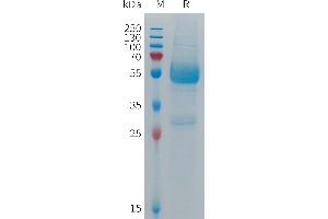 Human CD300LF Protein, hFc Tag on SDS-PAGE under reducing condition.