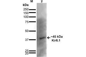 Western Blot analysis of Rat Brain showing detection of ~45 kDa Kir6. (KCNJ8 anticorps  (AA 306-424) (FITC))
