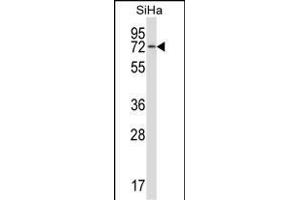 HSB Antibody (N-term) (ABIN657502 and ABIN2846527) western blot analysis in SiHa cell line lysates (35 μg/lane). (HSPA12B anticorps  (N-Term))