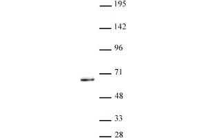 KLF5 antibody (pAb) tested by Western Blot. (KLF5 anticorps  (N-Term))