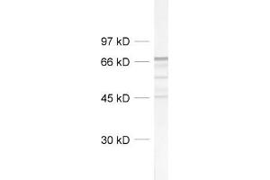 dilution: 1 : 1000, sample: rat brain homogenate (NEFL anticorps  (AA 1-284))