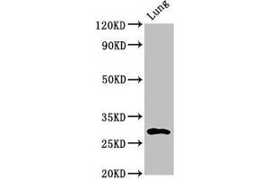 Western Blot Positive WB detected in: Rat lung tissue All lanes: SYNPR antibody at 3 μg/mL Secondary Goat polyclonal to rabbit IgG at 1/50000 dilution Predicted band size: 30, 32 kDa Observed band size: 30 kDa (Synaptoporin anticorps  (AA 199-265))