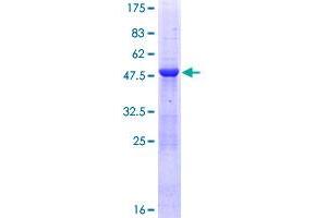 Image no. 1 for Mediator Complex Subunit 20 (MED20) (AA 1-212) protein (GST tag) (ABIN1310647)