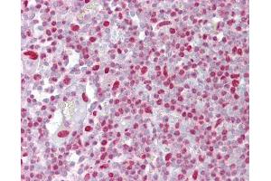 Anti-H2AX antibody IHC of human tonsil.