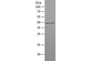 Western Blotting (WB) image for Arginase, Type II (ARG2) (AA 240-354) protein (His tag) (ABIN7121888)