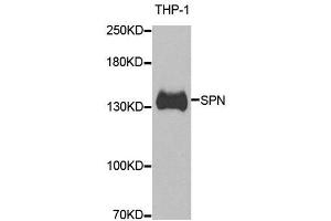 Western blot analysis of extracts of THP-1 cell line, using SPN antibody. (CD43 anticorps)