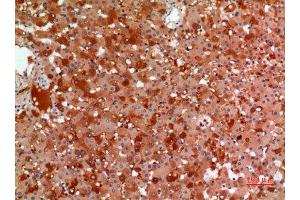 Immunohistochemistry (IHC) analysis of paraffin-embedded Human Liver, antibody was diluted at 1:100. (alpha 2 Macroglobulin anticorps  (Internal Region))