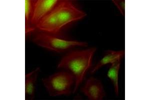 Immunofluorescence (IF) image for anti-Ubiquitin-Conjugating Enzyme E2S (UBE2S) (AA 1-222), (N-Term) antibody (ABIN452460)