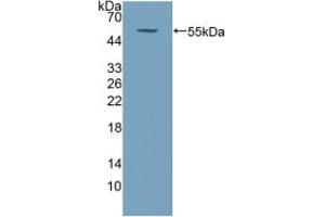 Western blot analysis of recombinant Human COQ6. (COQ6 anticorps  (AA 1-468))