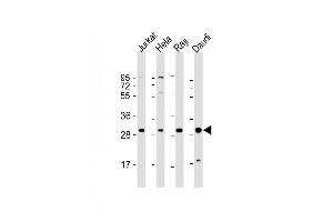 All lanes : Anti-ANP32A Antibody (Center) at 1:2000 dilution Lane 1: Jurkat whole cell lysate Lane 2: Hela whole cell lysate Lane 3: Raji whole cell lysate Lane 4: Daudi whole cell lysate Lysates/proteins at 20 μg per lane. (PHAP1 anticorps  (AA 133-162))
