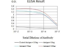 Black line: Control Antigen (100 ng),Purple line: Antigen (10 ng), Blue line: Antigen (50 ng), Red line:Antigen (100 ng) (BAX anticorps)