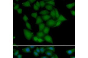 Immunofluorescence analysis of U2OS cells using CAMK1 Polyclonal Antibody (CAMK1 anticorps)