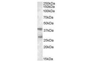 Image no. 1 for anti-Src Kinase Associated Phosphoprotein 2 (SKAP2) (C-Term) antibody (ABIN374180) (SKAP2 anticorps  (C-Term))