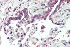 Human, Lung: Formalin-Fixed Paraffin-Embedded (FFPE)