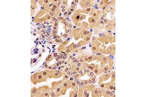 (ABIN6243211 and ABIN6577174) staining GDH in human kidney tissue sections by Immunohistochemistry (IHC-P - paraformaldehyde-fixed, paraffin-embedded sections). (GAPDH anticorps  (AA 43-335))
