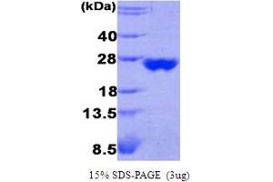 SDS-PAGE (SDS) image for Peroxiredoxin 3 (PRDX3) (AA 63-256) protein (ABIN667738) (Peroxiredoxin 3 Protein (PRDX3) (AA 63-256))