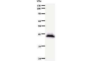Western Blotting (WB) image for anti-General Transcription Factor IIIC, Polypeptide 2, beta 110kDa (GTF3C2) antibody (ABIN931065)