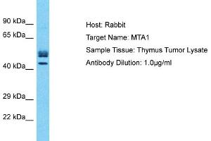 Host: Rabbit Target Name: MTA1 Sample Type: Thymus Tumor lysates Antibody Dilution: 1. (MTA1 anticorps  (Middle Region))