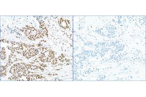 Immunohistochemistry (IHC) image for anti-Replication Protein A2, 32kDa (RPA2) (pSer4), (pSer8) antibody (ABIN7455212) (RPA2 anticorps  (pSer4, pSer8))