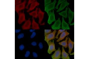 ABIN6257478 and ABIN6273810 staining Hela cells(45 min of heat-shock treatment) by IF/ICC.