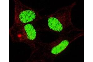 Fluorescent confocal image of SY5Y cells stained with phospho-LIN28 antibody. (LIN28A anticorps  (pSer134))