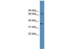 Image no. 1 for anti-Splicing Factor 4 (SF4) (C-Term) antibody (ABIN6745313) (Splicing Factor 4 anticorps  (C-Term))