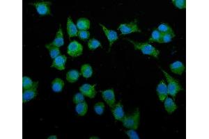 IF analysis of Podoplanin/gp36/Pdpn using anti-Podoplanin/gp36/Pdpn antibody (ABIN7600811). (Podoplanin anticorps  (AA 24-172))