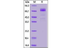 Biotinylated Human CD36, His,Avitag on  under reducing (R) condition.