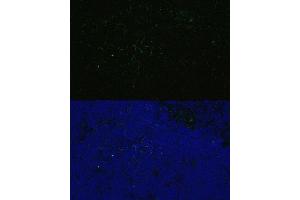 Immunofluorescence analysis of Mouse thymus using CD4 antibody (ABIN6132069, ABIN6138186, ABIN6138188 and ABIN6213820) at dilution of 1:100.