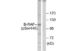 Immunohistochemistry analysis of paraffin-embedded human brain tissue using B-RAF (Phospho-Ser446) antibody.