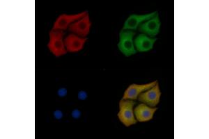 SOD2/MnSOD Mouse Monoclonal Antibody staining Hela cells by IF/ICC.