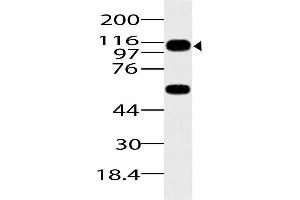 Image no. 1 for anti-ArfGAP with SH3 Domain, Ankyrin Repeat and PH Domain 1 (ASAP1) (AA 912-1115) antibody (ABIN5027041)