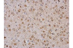 IHC-P Image Galanin Receptor 2 antibody detects Galanin Receptor 2 protein at membrane and cytosol on rat fore brain by immunohistochemical analysis. (GALR2 anticorps  (C-Term))