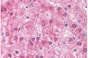 Human Liver (formalin-fixed, paraffin-embedded) stained with EIF2AK2 antibody ABIN213926 at 5 ug/ml followed by biotinylated goat anti-rabbit IgG secondary antibody ABIN481713, alkaline phosphatase-streptavidin and chromogen. (EIF2AK2 anticorps  (N-Term))