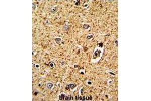 Immunohistochemistry (IHC) image for anti-Tryptophan Hydroxylase 1 (TPH1) antibody (ABIN3002887)