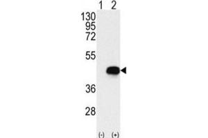 Western Blotting (WB) image for anti-Branched Chain Ketoacid Dehydrogenase Kinase (BCKDK) antibody (ABIN3003001) (BCKDK anticorps)