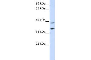 WB Suggested Anti-SLC25A34 Antibody Titration:  0. (SLC25A34 anticorps  (Middle Region))