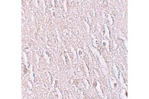 Immunohistochemical staining of human brain cells with ZBTB5 polyclonal antibody  at 2. (ZBTB5 anticorps  (C-Term))