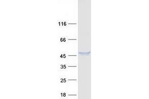Validation with Western Blot