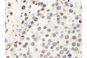 Immunohistochemistry (IHC) image for anti-Cell Division Cycle 25 Homolog C (S. Pombe) (CDC25C) (AA 150-200) antibody (ABIN7448466)