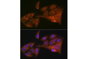 Immunofluorescence analysis of U-2 OS cells using HE4/WFDC2 Rabbit mAb (ABIN1682653, ABIN3017632, ABIN3017633 and ABIN7101513) at dilution of 1:100 (40x lens). (WFDC2 anticorps)