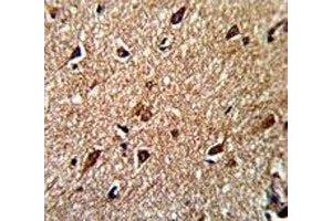 IHC analysis of FFPE human brain stained with IDH antibody (IDH1 anticorps  (AA 63-90))