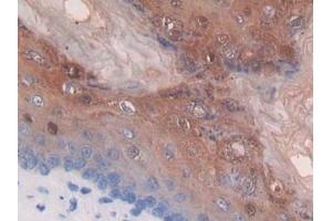 DAB staining on IHC-P; Samples: Mouse Stomach Tissue (Thymidine Phosphorylase anticorps  (AA 29-305))