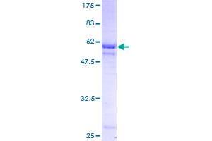 Image no. 1 for PIH1 Domain Containing 1 (PIH1D1) (AA 1-290) protein (GST tag) (ABIN1315057)