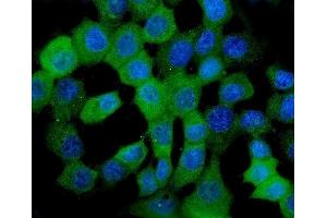 IF analysis of HSPB8/Hsp22 using anti-HSPB8/Hsp22 antibody (ABIN7599067). (HSPB8 anticorps  (AA 1-196))