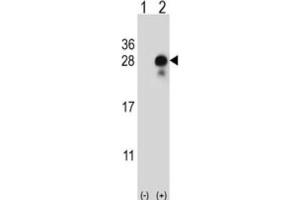 Western Blotting (WB) image for anti-delta-Like 2 Homolog (DLK2) antibody (ABIN5024466) (DLK2 anticorps)