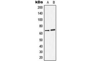 Western blot analysis of Arylsulfatase D expression in A549 (A), ZR751 (B) whole cell lysates. (Arylsulfatase D anticorps  (Center))