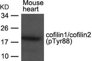 Western blot analysis of extracts from Mouse heart tissue using cofilin1/cofilin2(phospho-Tyr88) Antibody. (Cofilin1/2 (CFL1/2) (pTyr88) anticorps)
