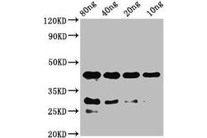 anti-Notch Homolog, Like (NOTCHL) (AA 683-784) antibody